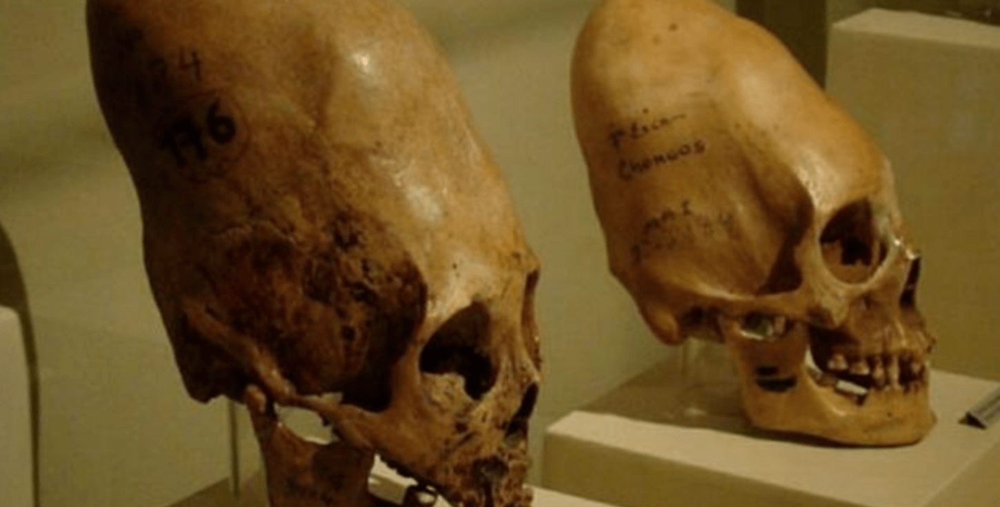 DNA Tests Reveal That Paracas Skulls Are Not Human